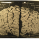 El cerebro de Einstein. Nature